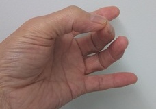 リモート施術の実績